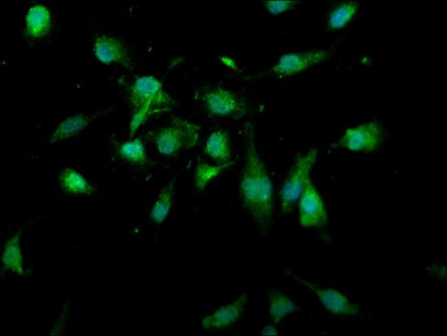 100UG USP4 ANTIBODY 100 ug