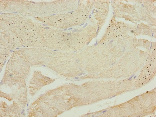 100UL CALCOCO2 ANTIBODY 100 ul