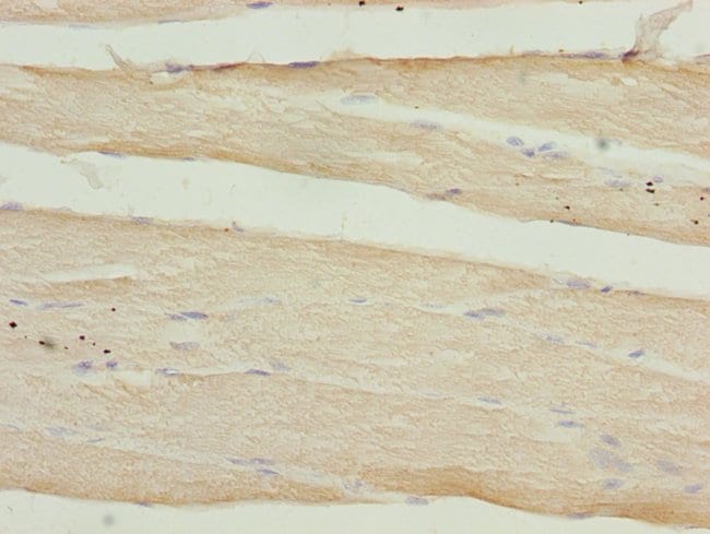100UL CALCOCO2 ANTIBODY 100 ul