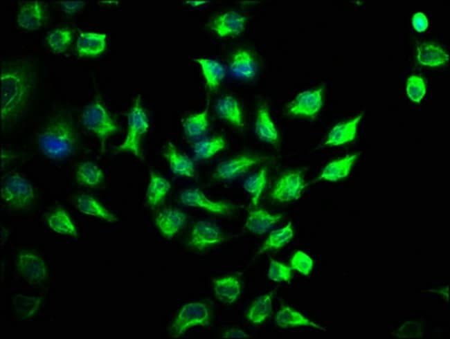 100UL MST2 ANTIBODY 100 ul