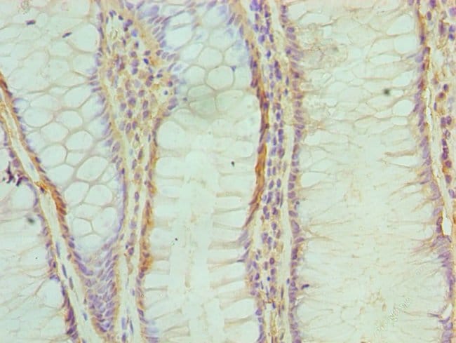 100UL ABH1 ANTIBODY 100 ul