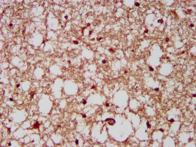 100UG CUX1 ANTIBODY 100 ug
