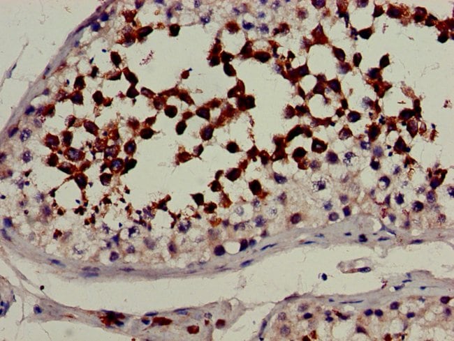 100UG CYP51A1 ANTIBODY 100 ug