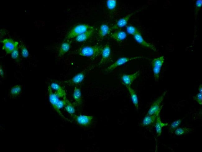 100UG NFATC3 ANTIBODY 100 ug