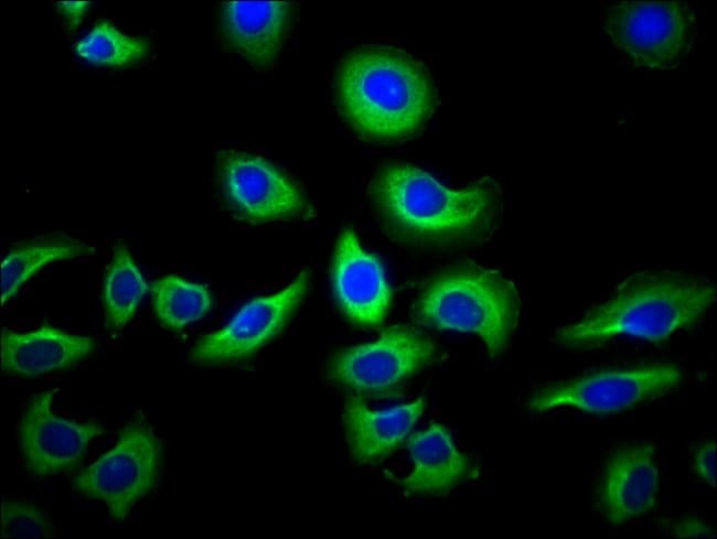 100UG NAIP ANTIBODY 100 ug