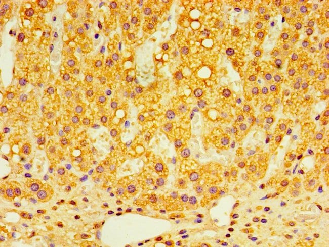 100UL GPS1 ANTIBODY 100 ul