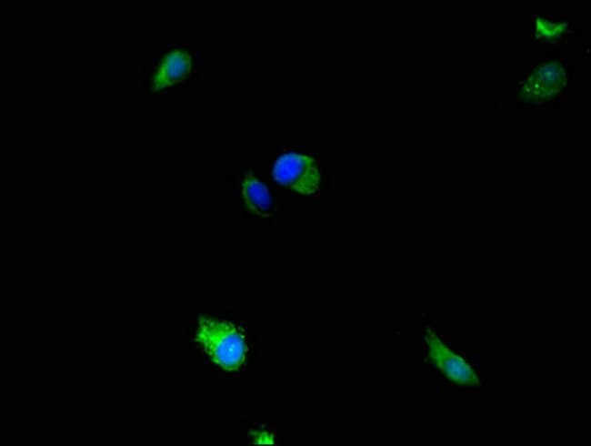 100UG MEK5 ANTIBODY 100 ug