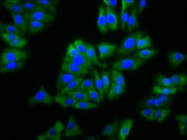 100UG BFSP2 ANTIBODY 100 ug