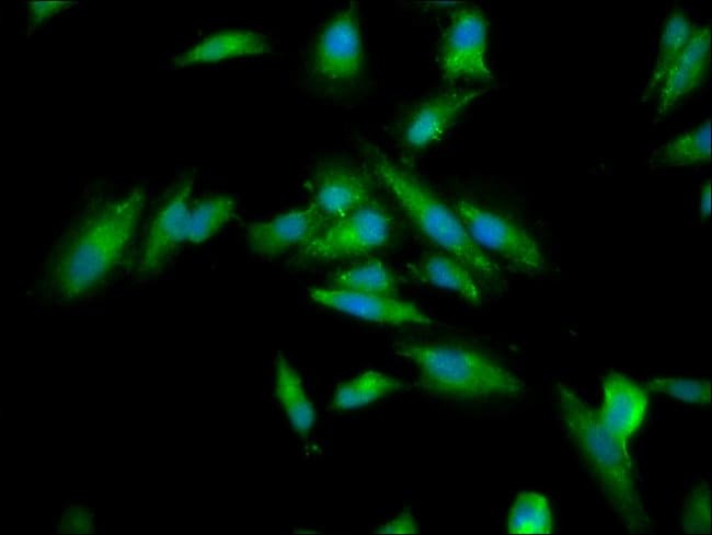 100UG CKAP5 ANTIBODY 100 ug