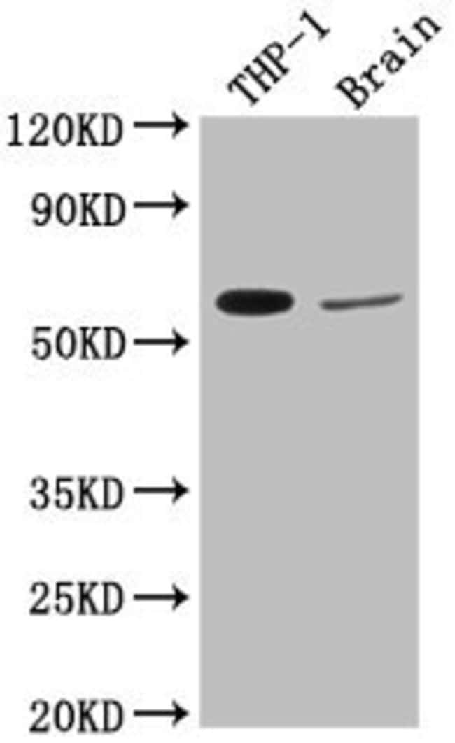 100UL COL9A2 ANTIBODY 100 ul