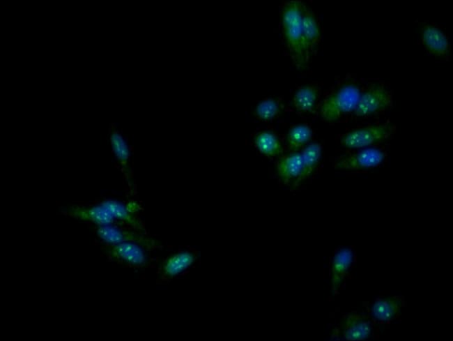 100UG DMC1 ANTIBODY 100 ug