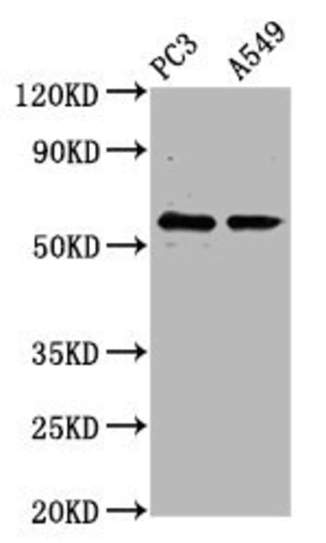 100UG CYP1B1 ANTIBODY 100 ug