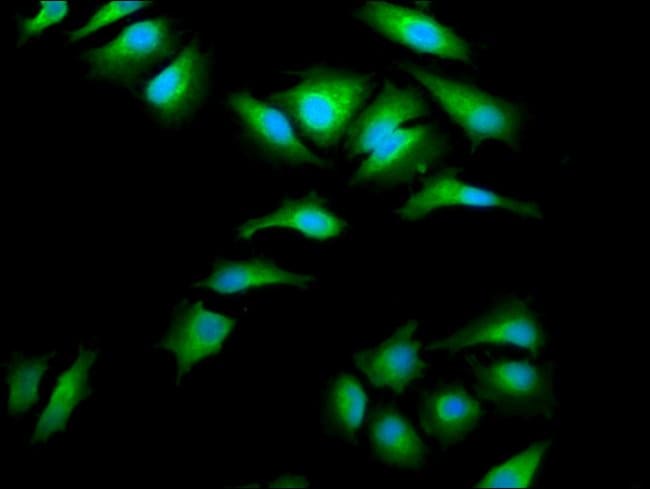 100UG EMAP II ANTIBODY 100 ug