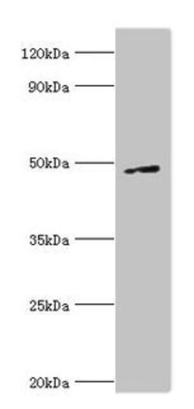 100UL CTBP1 ANTIBODY 100 ul