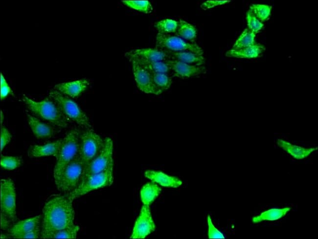 100UG MADCAM-1 ANTIBODY 100 ug