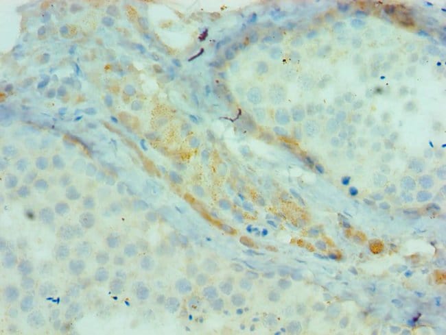 100UL CIAP1 ANTIBODY 100 ul