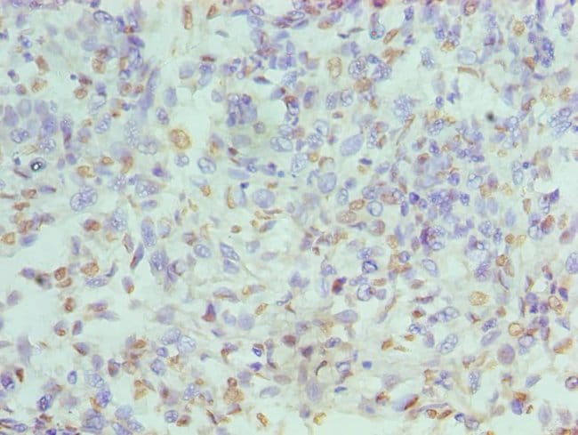 100UL HNRNP D ANTIBODY 100 ul