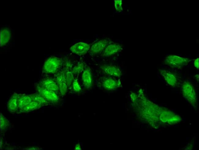 100UG ASC1 ANTIBODY 100 ug