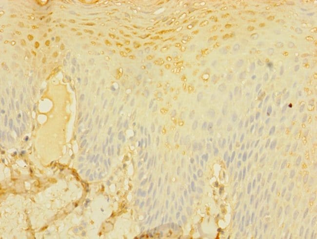 100UL CD226 (DNAM-1) ANTIBODY 100 ul
