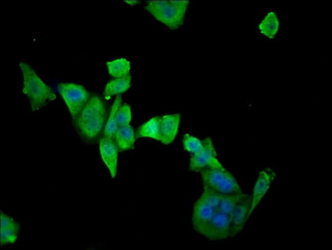 100UL ETFDH ANTIBODY 100 ul
