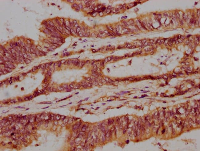 100UG NPRL3 ANTIBODY 100 ug