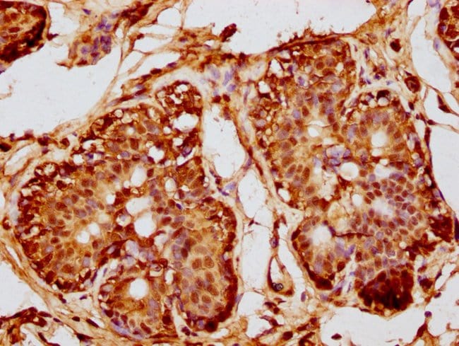 100UL MKP2 ANTIBODY 100 ul