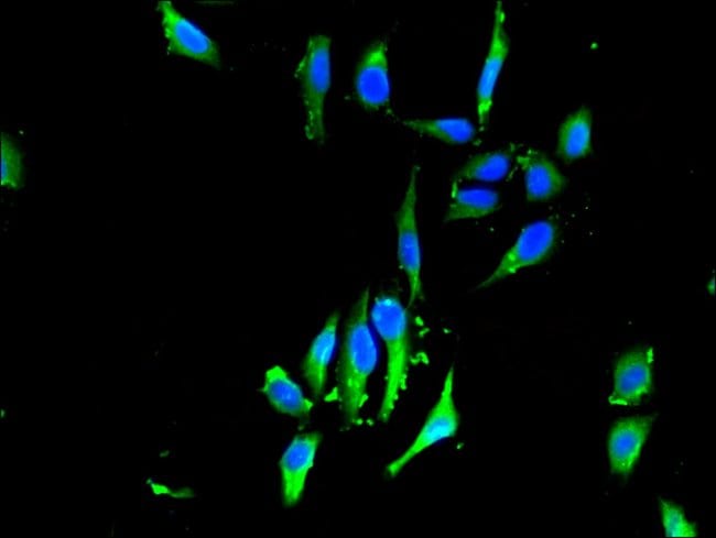 100UG FHL1 ANTIBODY 100 ug