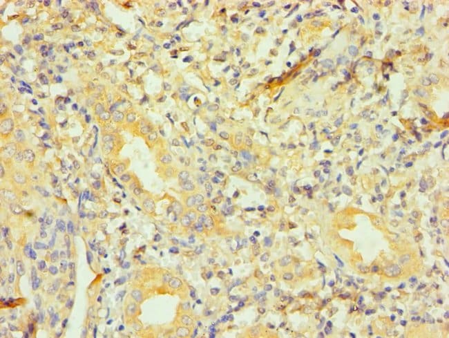 100UL DYNACTIN 1 ANTIBODY 100 ul