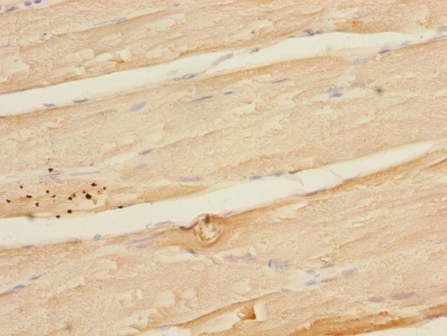 100UL MAPKAPK3 ANTIBODY 100 ul