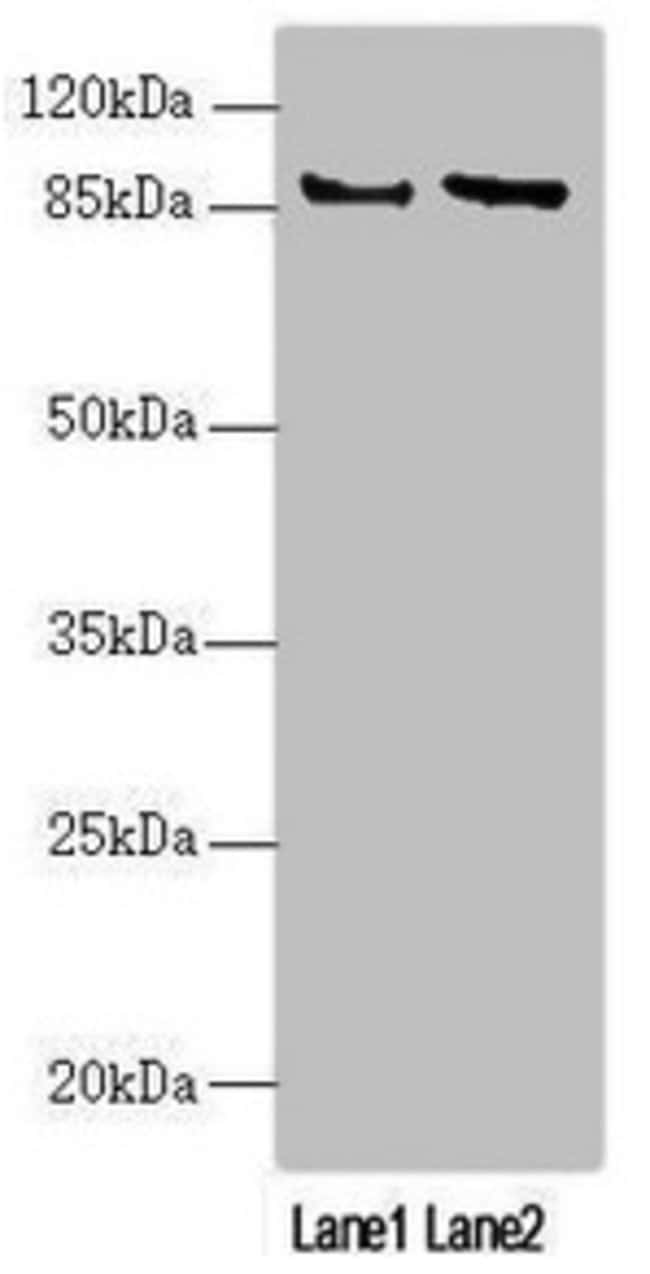 100UL JIP2 ANTIBODY 100 ul