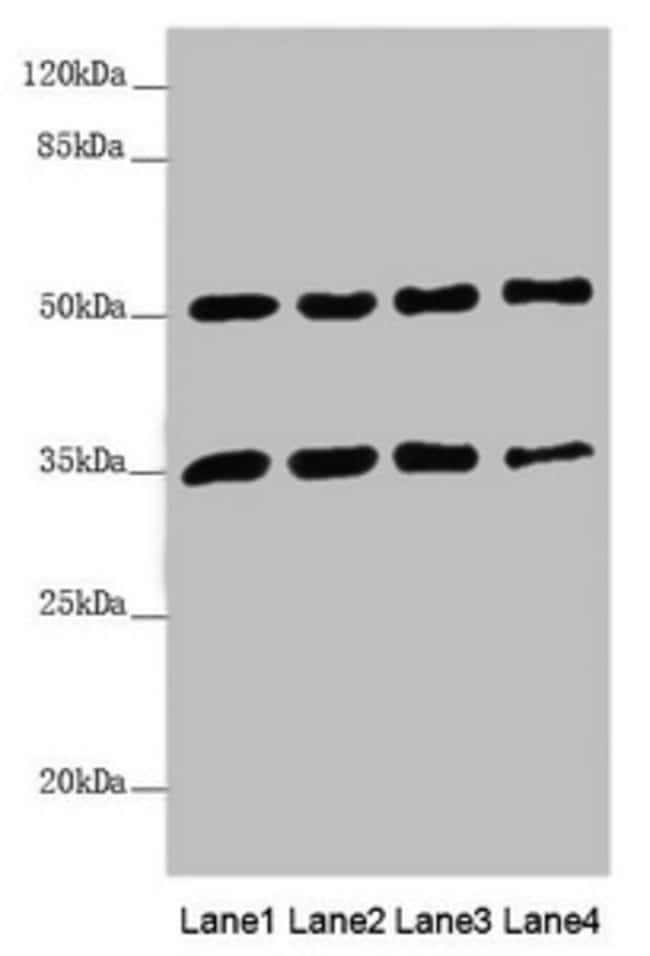 100UL MTX1 ANTIBODY 100 ul