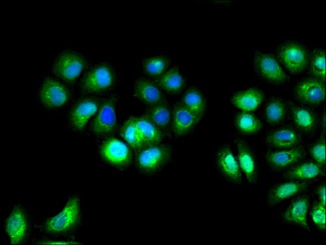 100UG IL10RA ANTIBODY 100 ug