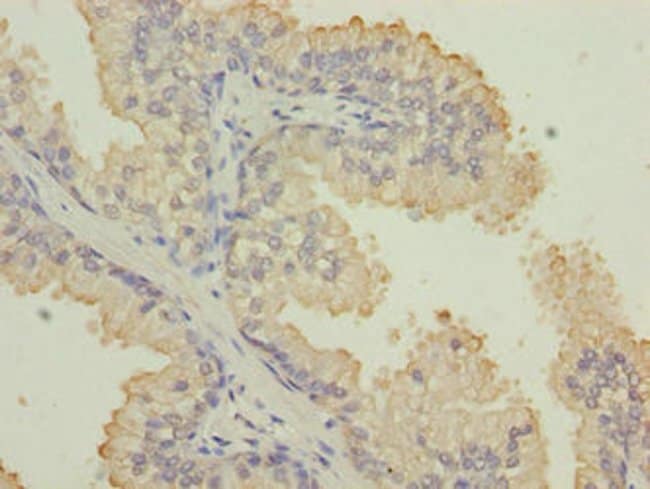 100UG CYTOKERATIN 33B ANTIBODY 100 ug
