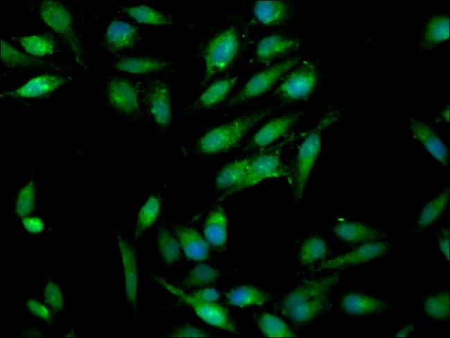 100UG RAB3GAP1 ANTIBODY 100 ug