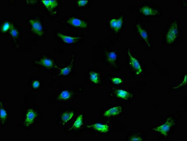 100UG TRADD ANTIBODY 100 ug