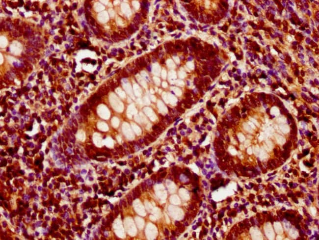 100UG ITSN1 ANTIBODY 100 ug