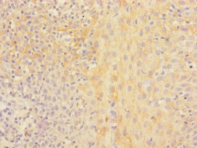 100UL CHRNA2 ANTIBODY 100 ul