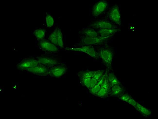 100UG FOXI1 ANTIBODY 100 ug