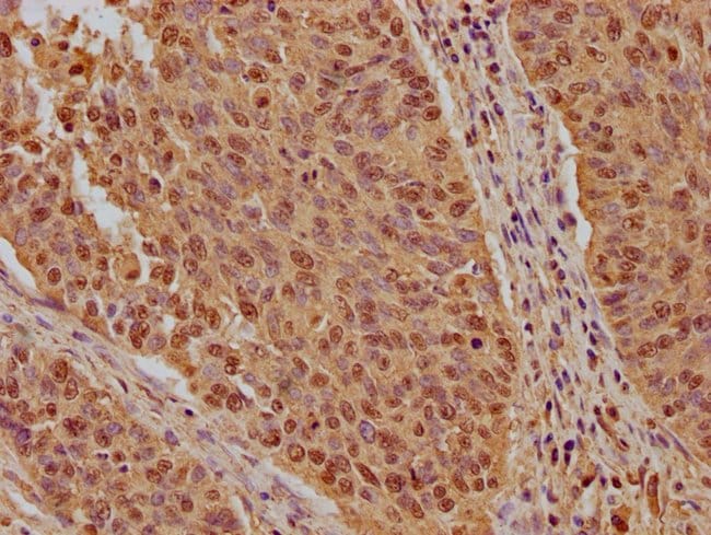 100UL KPNB1 ANTIBODY 100 ul