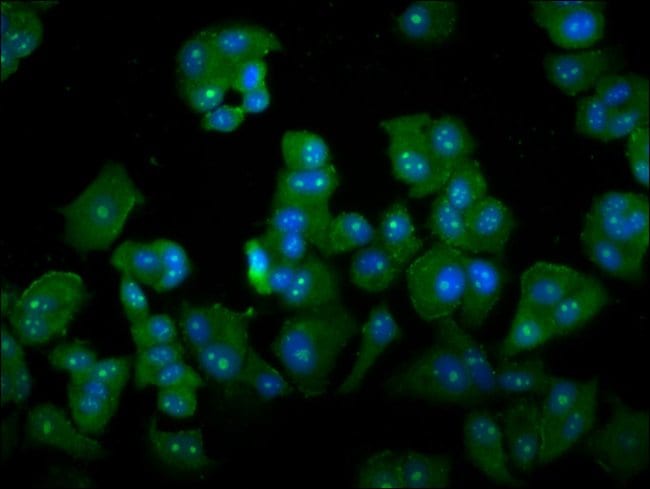 100UG DAZAP2 ANTIBODY 100 ug