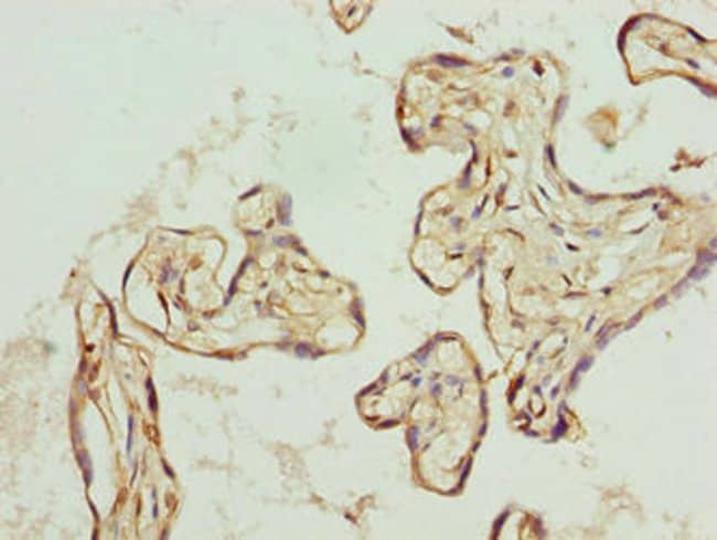 100UG TRIP13 ANTIBODY 100 ug