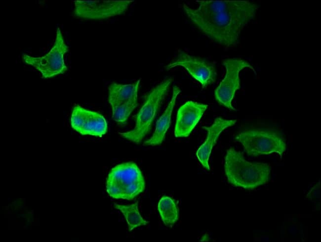 100UG CCDC6 ANTIBODY 100 ug