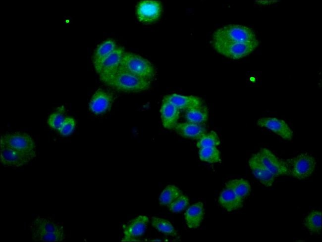100UG DOK7 ANTIBODY 100 ug