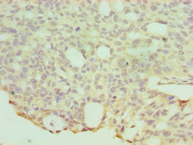 100UL HYAL1 ANTIBODY 100 ul