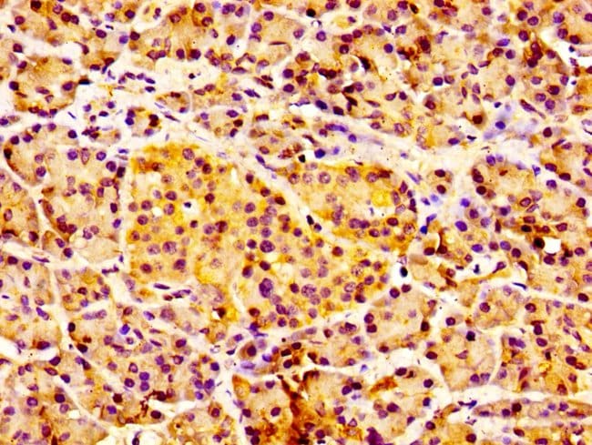 100UG IL18R1 ANTIBODY 100 ug