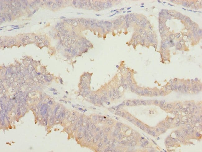100UL EIF2B ALPHA ANTIBODY 100 ul
