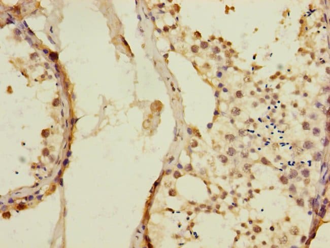 100UL KIZUNA ANTIBODY 100 ul