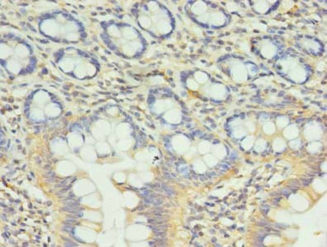 100UG CCDC57 ANTIBODY 100 ug