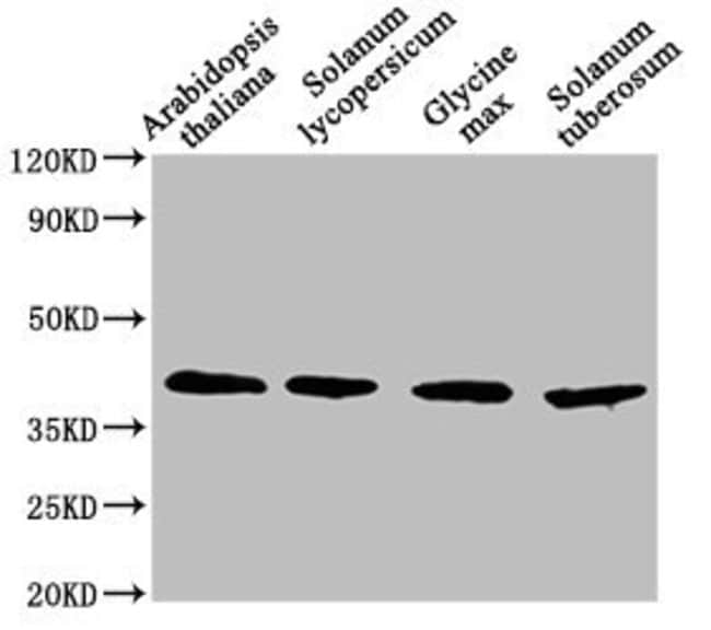 100UL AOX1A ANTIBODY 100 ul