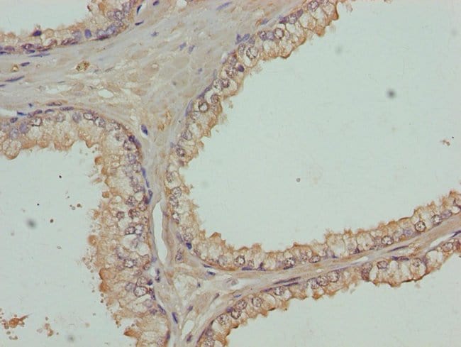100UL FBXO7 ANTIBODY 100 ul